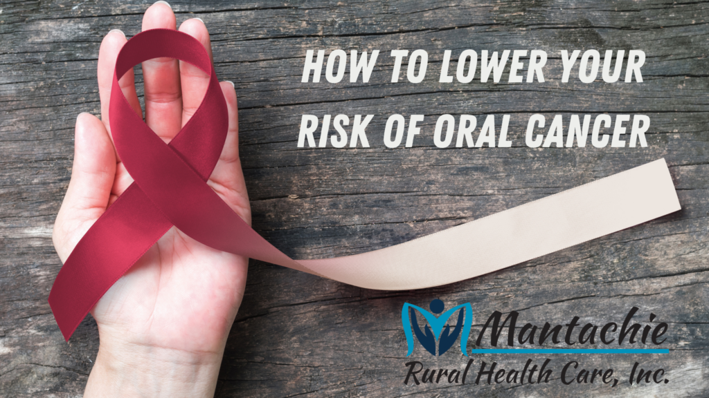 How To Lower Your Risk Of Oral Cancer - Mantachie Rural Health Care, Inc.